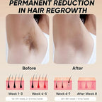 Laser Hair Removal Device, Pulse light hair removal device at home 500,000 flashes, Permanent Laser Hair Removal for women and men, Painless hair removal device for armpits, legs, arms