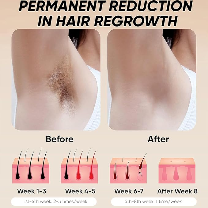 Laser Hair Removal Device, Pulse light hair removal device at home 500,000 flashes, Permanent Laser Hair Removal for women and men, Painless hair removal device for armpits, legs, arms